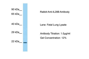 IL28B Rabbit Polyclonal Antibody