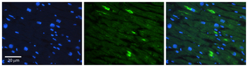 ADGRE5 Rabbit Polyclonal Antibody