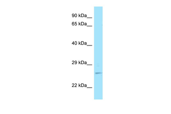 RAB11A Rabbit Polyclonal Antibody