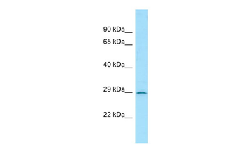 IL3RA Rabbit Polyclonal Antibody
