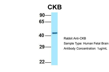 CKB Rabbit Polyclonal Antibody