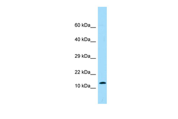 PROK2 Rabbit Polyclonal Antibody