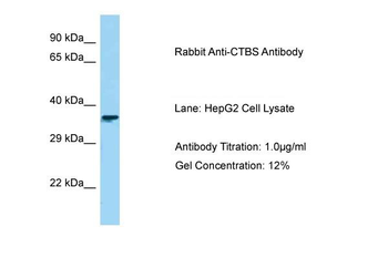 CTBS Rabbit Polyclonal Antibody