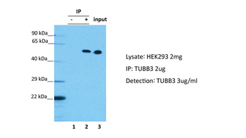 TUBB3 Rabbit Polyclonal Antibody