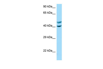 CAMK1 Rabbit Polyclonal Antibody