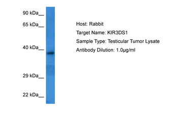 KIR3DS1 Rabbit Polyclonal Antibody