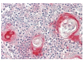 FADS2 Rabbit Polyclonal Antibody