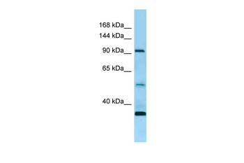 ROR1 Rabbit Polyclonal Antibody