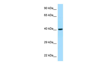 FUT3 Rabbit Polyclonal Antibody