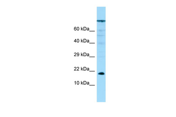 PPP1R14A Rabbit Polyclonal Antibody