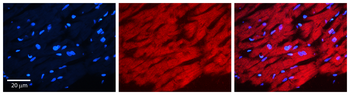 PICALM Rabbit Polyclonal Antibody