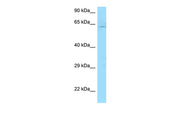 PICALM Rabbit Polyclonal Antibody