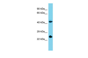 Stra8 Rabbit Polyclonal Antibody