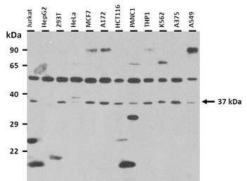 STRA8 Rabbit Polyclonal Antibody