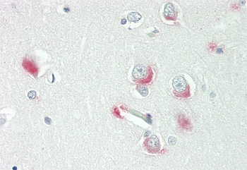 WASF1 Rabbit Polyclonal Antibody