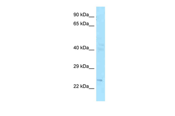 FGF20 Rabbit Polyclonal Antibody