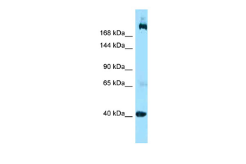SHANK2 Rabbit Polyclonal Antibody