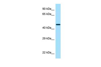 CRHR2 Rabbit Polyclonal Antibody