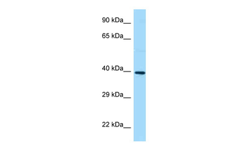 GNB5 Rabbit Polyclonal Antibody