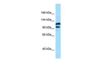 DPP9 Rabbit Polyclonal Antibody