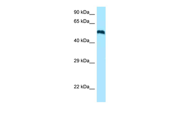 CERK Rabbit Polyclonal Antibody
