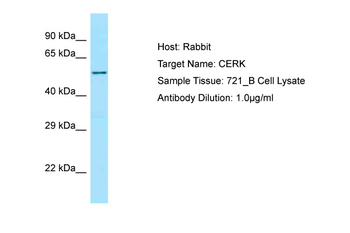 CERK Rabbit Polyclonal Antibody