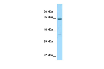 BCO1 Rabbit Polyclonal Antibody