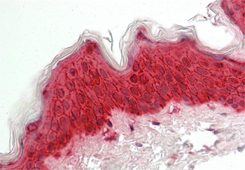 LGALS7 Rabbit Polyclonal Antibody
