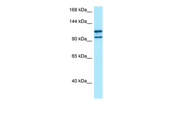 MYO10 Rabbit Polyclonal Antibody