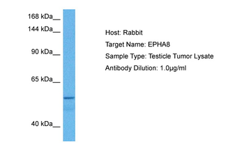 EPHA8 Rabbit Polyclonal Antibody