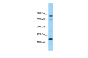 CDK2AP1 Rabbit Polyclonal Antibody