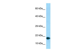 NUPR1 Rabbit Polyclonal Antibody