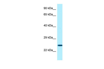 SOSTDC1 Rabbit Polyclonal Antibody