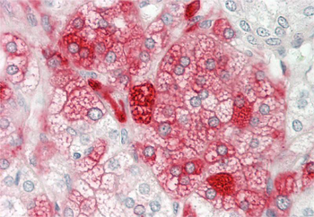 NEU2 Rabbit Polyclonal Antibody