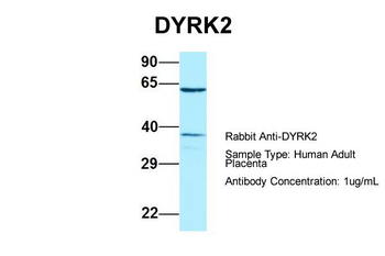 DYRK2 Rabbit Polyclonal Antibody