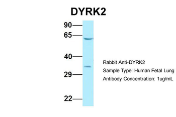 DYRK2 Rabbit Polyclonal Antibody