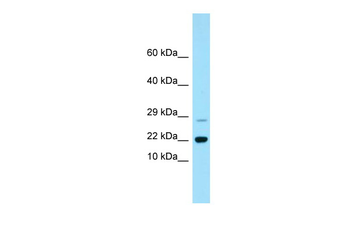RAP2B Rabbit Polyclonal Antibody