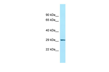 ORAI3 Rabbit Polyclonal Antibody