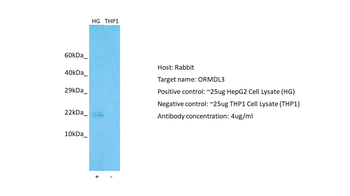 ORMDL3 Rabbit Polyclonal Antibody