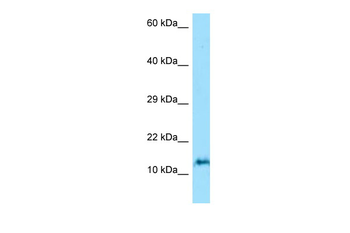 ORMDL3 Rabbit Polyclonal Antibody