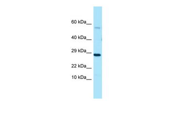 PDE7A Rabbit Polyclonal Antibody