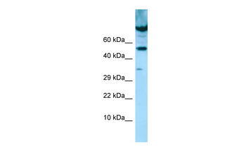 PDE7A Rabbit Polyclonal Antibody