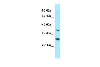 HYI Rabbit Polyclonal Antibody