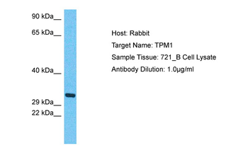TPM1 Rabbit Polyclonal Antibody