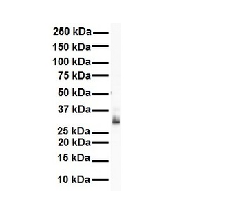 TPM1 Rabbit Polyclonal Antibody