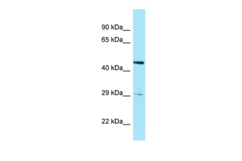HTRA3 Rabbit Polyclonal Antibody