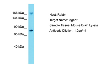 Iqgap2 Rabbit Polyclonal Antibody