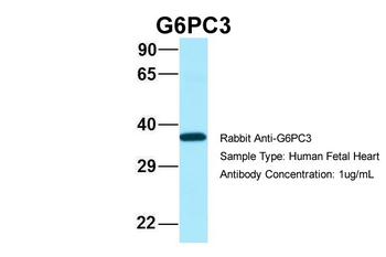 G6PC3 Rabbit Polyclonal Antibody