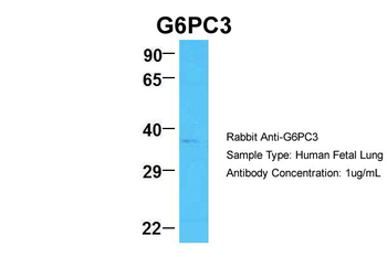 G6PC3 Rabbit Polyclonal Antibody