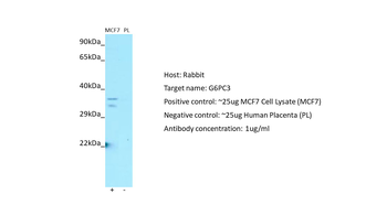 G6PC3 Rabbit Polyclonal Antibody